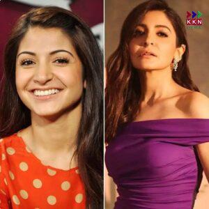 Bollywood Actresses Who Got Trolled for Plastic Surgery