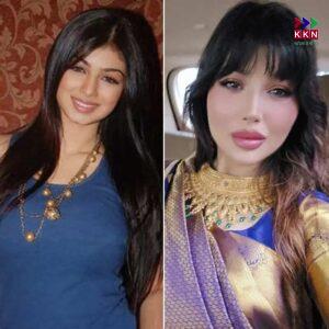 Bollywood Actresses Who Got Trolled for Plastic Surgery